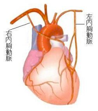 冠動脈バイパス手術