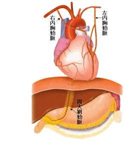 バイパスに用いる血管について